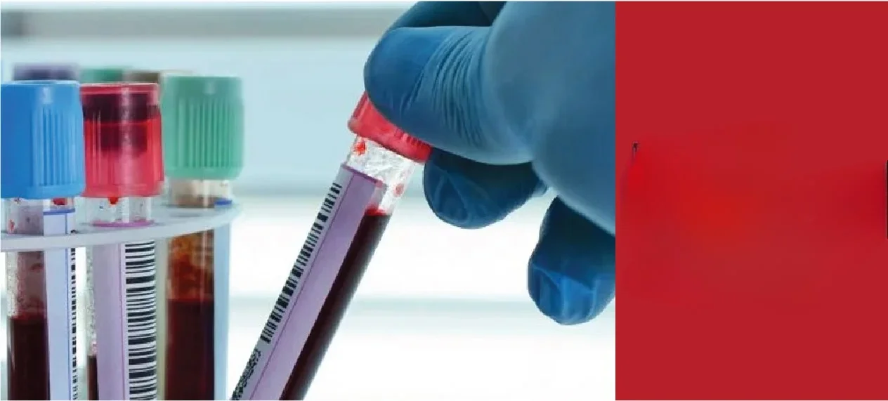 Types of Haematology Oncology Treatment In Udaipur